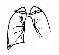 右侧少量胸腔积液