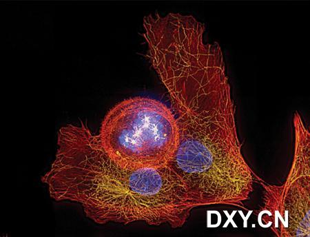 染色体（蓝色）周围正在形成的微管