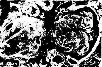 大鼠肾冷冻割断扫描电镜示肾小体