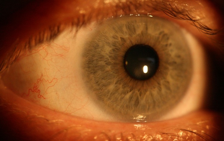 瞳孔.jpg