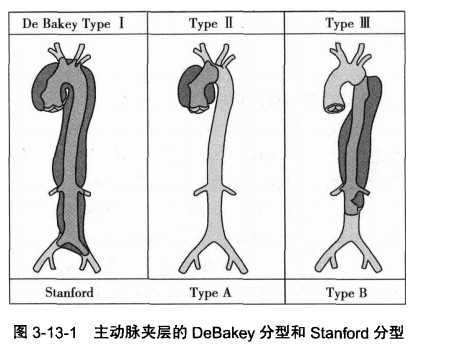 主动脉夹层.jpg