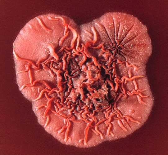 文件:Penicillium marneffei colony.jpg