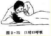 口对口呼吸