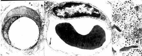 毛细血管电镜像