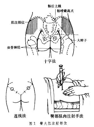 文件:臀大肌注射部位.jpg