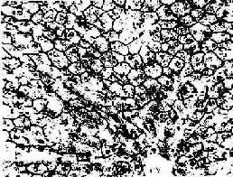 兔肝硝酸银浸染示胆小管