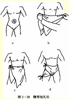 腹部三角巾包扎法