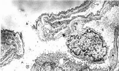 人肺电镜像示肺泡孔