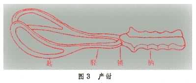 文件:产钳.jpg