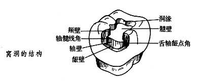 文件:窝洞的结构.jpg