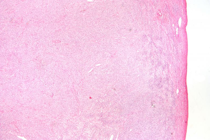 文件:Thecoma low mag.jpg