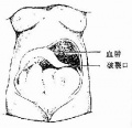 2014年1月18日 (六) 13:56的版本的缩略图