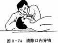 2014年1月18日 (六) 12:36的版本的缩略图